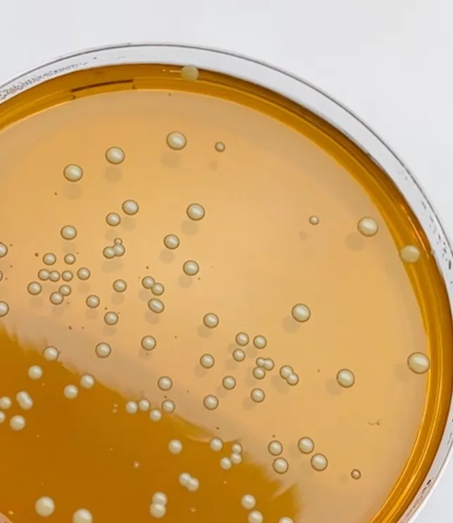 Szalka Petriego z hodowlą bakterii &ndash; badania nad skutecznością probiotyk&oacute;w YUN Probiotherapy